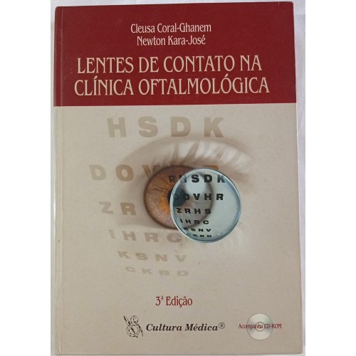 LENTES DE CONTATO NA CLINICA OFTALMOLÓGICA/CLEUSA CORAL-GHANEM/NEWTON KARA-JOSÉ 