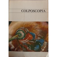 COLPOSCOPIA/CLÓVIS SALGADO COLPOSCOPIA/CLÓVIS SALGADO
