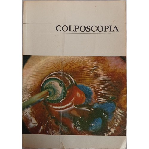 COLPOSCOPIA/CLÓVIS SALGADO