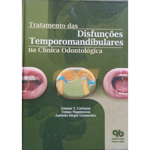 TRATAMENTO DAS DISFUNÇÕES TEMPOROMANDIBULARES NA CLÍNICA ODONTOLÓGICA