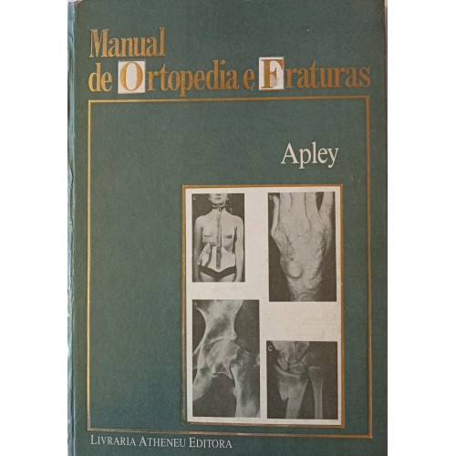 MANUAL DE ORTOPEDIA E FRATURAS/APLEY